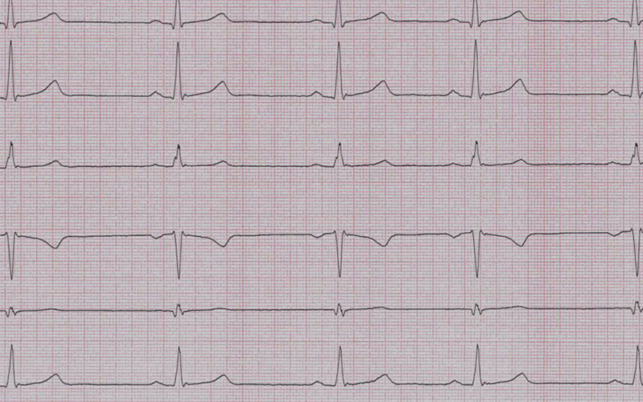 EKG-Bild Internistsen Böblingen